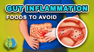 Top 5 Foods that Cause GUT Inflammation  AVOID  eat these anti inflammatory foods [upl. by Drofniw93]