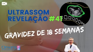 Gravidez 18 semanas  Descobrindo o sexo do bebê AO VIVO Ultrassom Revelação 40 [upl. by Melisande523]