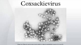 Coxsackievirus [upl. by Eldwin]