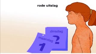 Rode hond  Symptomen en behandeling [upl. by Enined78]