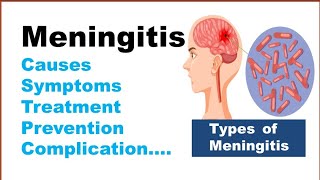 Meningitis  Types Causes Symptoms Treatment [upl. by Odlawso]