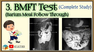 BMFT complete procedure Barium Meal Follow Through examination [upl. by Jermaine]