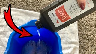 Put Hydrogen Peroxide on your FEET amp SEE WHAT HAPPENS 💥 this is cool and surprising [upl. by Webster]