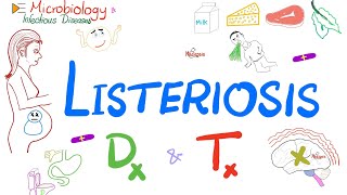 Listeria monocytogenes Listeriosis  Diagnosis and Treatment  Microbiology 🧫 [upl. by Baldridge]