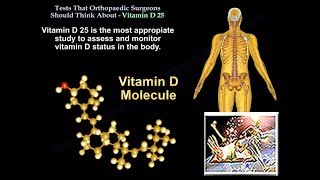 25 Vitamin D Tests Ortho Surgeons Think About Everything You Need To Know  Dr Nabil Ebraheim [upl. by Wenn]