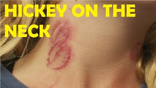 learn how to give someone a hickey on the neck [upl. by Adnoryt]