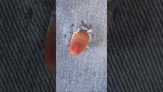 How to fix this hole shortfeed sewingsecrets stitching stitchingideas craft sew diy howto [upl. by Zurciram]