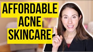 Affordable Skincare For Acne Prone Skin [upl. by Kowal394]