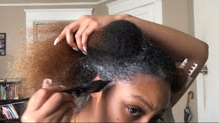 Grow Back HAIR AND EDGES FAST  Monistat 7 Scalp Treatment for Hair Growth [upl. by Azaleah266]