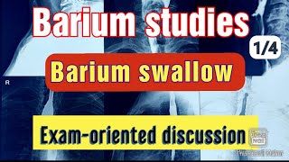 Barium swallow of Oesophagus l Examoriented discussion l Professor Tapan Kumar Jana [upl. by Ardnala735]