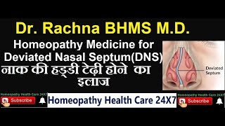 Homeopathy medicine for deviated nasal septum [upl. by Nnaul]