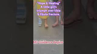 Hope and Healing A little girls triumph over tibia and fibula fracture [upl. by Arriec]