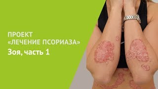 Проект Лечение псориаза Зоя часть 1 [upl. by Orest557]