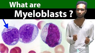 What are Myeloblasts   Clear amp Complete Overview [upl. by Aleuname66]