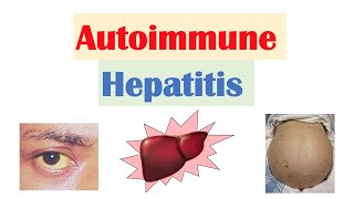 Autoimmune Hepatitis  Pathogenesis Signs amp Symptoms Diagnosis Treatment [upl. by Judi]