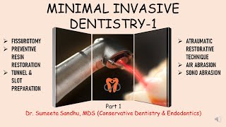 Minimal Invasive Dentistry Atraumatic restorative technique Tunnel amp Slot Preparation Fissurotomy [upl. by Elohcin]