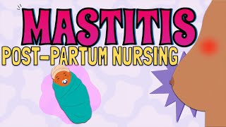 MASTITIS Maternal Newborn Nursing [upl. by Reena]