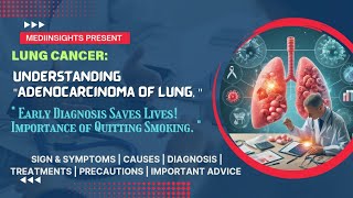 Understanding Adenocarcinoma of Lung Symptoms Causes Diagnosis and Treatments  MediInsights [upl. by Niffirg551]