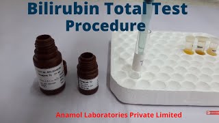 Bilirubin Test Procedure  Bilirubin Total Test [upl. by Seraphina]