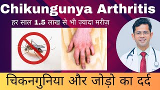 चिकनगुनिया और जोड़ो का दर्द  Chikungunya Arthritis  Chikungunya Fever [upl. by Palua470]