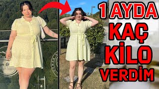 1 AYDA KAÇ KİLO VERDİM  TÜP MİDE 1 AY [upl. by Andria]