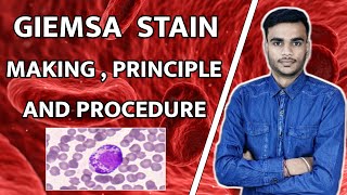 What Is Giemsa Stain  Giemsa Stain Procedure  Giemsa Staining  Giemsa Stain Principle [upl. by Lleinnad878]