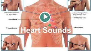 Heart Sounds S1S2S3and others [upl. by Raynard]