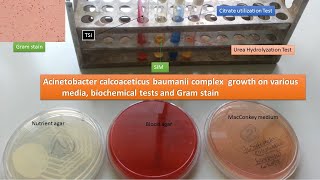 Acinetobacter Identification in Laboratory [upl. by Ariajaj]