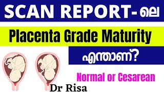 Placenta Grade in Scan Report Malayalam  Placenta Position [upl. by Eilrebma847]