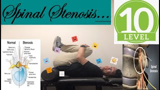 Major Exercises of Lumbar Spinal StenosisBack PainWeakness of legNumbnessTingling  Level 10 [upl. by Arikahs948]