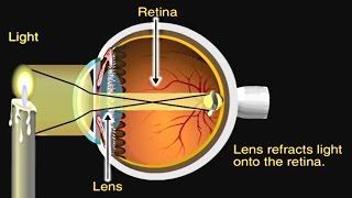 Myopia and Hypermetropia [upl. by Eillib]