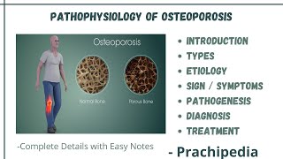 Pathophysiology Of Osteoporosis [upl. by Cleary]