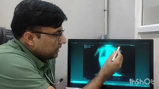 How to Interpret an Xray I Neonatologist I NICU [upl. by Fagin]