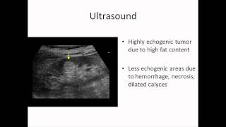 Angiomyolipoma of Kidney [upl. by Katine461]