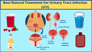 Best Urinary Tract Infection UTI Treatment At Home Quickly  Natural Remedies for UTI Men amp Women [upl. by Anelaf]