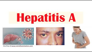 Hepatitis A  Virus Risk Factors Pathophysiology Signs amp Symptoms Diagnosis Treatment [upl. by Alvord]