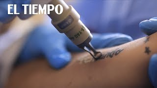 El arte de borrar tatuajes con láser  El Tiempo [upl. by Crowley]