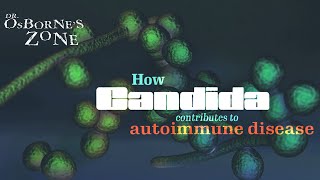 How Candida Contributes to Autoimmune Disease  Dr Osbornes Zone [upl. by Ellenehc]