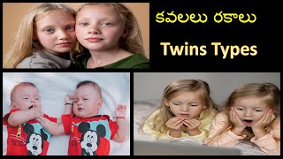 కవలలు ఎందుకు పుడతారంటే  Types of Twins  Identical twins  Fraternal twins  Siamese twins  Twins [upl. by Anihtyc916]