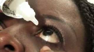 Ophthalmology How to instill your eyedrops [upl. by Vick]