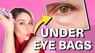 How To Get Rid Of Under Eye Bags amp Puffy Eyes  Dr Shereene Idriss [upl. by Ettevol]