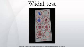 Widal test [upl. by Aliza]