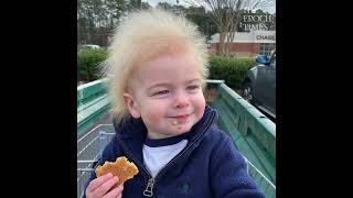 Boy With Rare Uncombable Hair Syndrome Brings a Smile to Faces [upl. by Suvart]