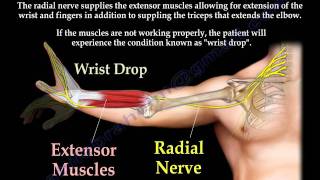 Radial Nerve Palsy injury  WRIST DROP  Everything You Need To Know  Dr Nabil Ebraheim [upl. by Banna935]