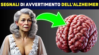 SCIENTIFICO Queste 5 Abitudini Sono Legate allAlzheimer [upl. by Fernand747]