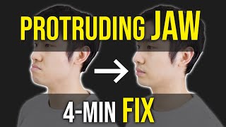 Protruding Jaw  Underbite Fix ｜Facial Asymmetry Correction｜Corrective Exercises [upl. by Saber]