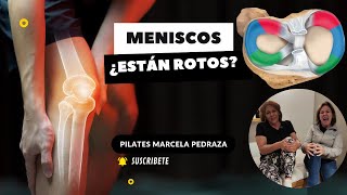 MENISCOS ¿ESTÁN ROTOS [upl. by Verlee]