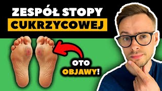 Powikłania cukrzycy STOPA CUKRZYCOWA  Objawy które muszą znać osoby z cukrzycą  Nie słodzę [upl. by Derril]