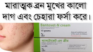 বেটনোভেট ক্রিম এর কাজ  Betnovate N cream  সঠিক ব্যবহারের নিয়ম  উপকারিতা  Skin ক্রিম এবং Ointment [upl. by Nareik252]