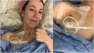 ♡ Getting a Hickman Line amp Starting TPN 251018  Amys Life ♡ [upl. by Veronique]